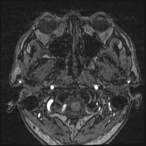 Click on the Serie image to view the images of VILLANUEVA, WILLIAM A.